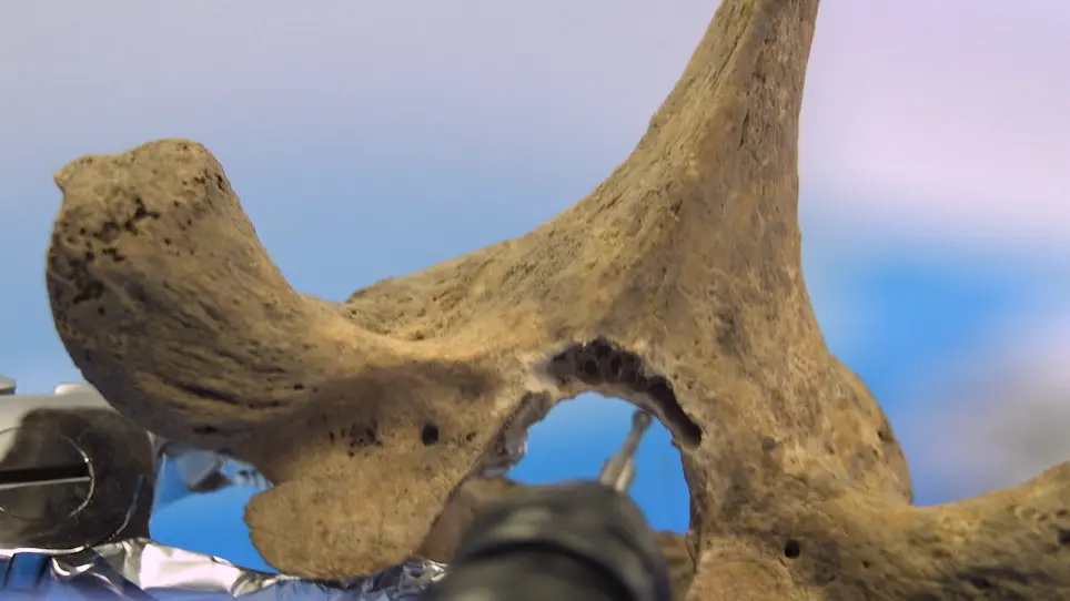 Optimized Bone Sampling Protocols for the Retrieval of Ancient DNA from Archaeological Remains