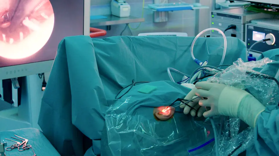 Endoscopic Cholesteatoma Surgery