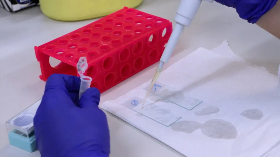Detection of Post-Replicative Gaps Accumulation and Repair in Human Cells Using the DNA Fiber Assay