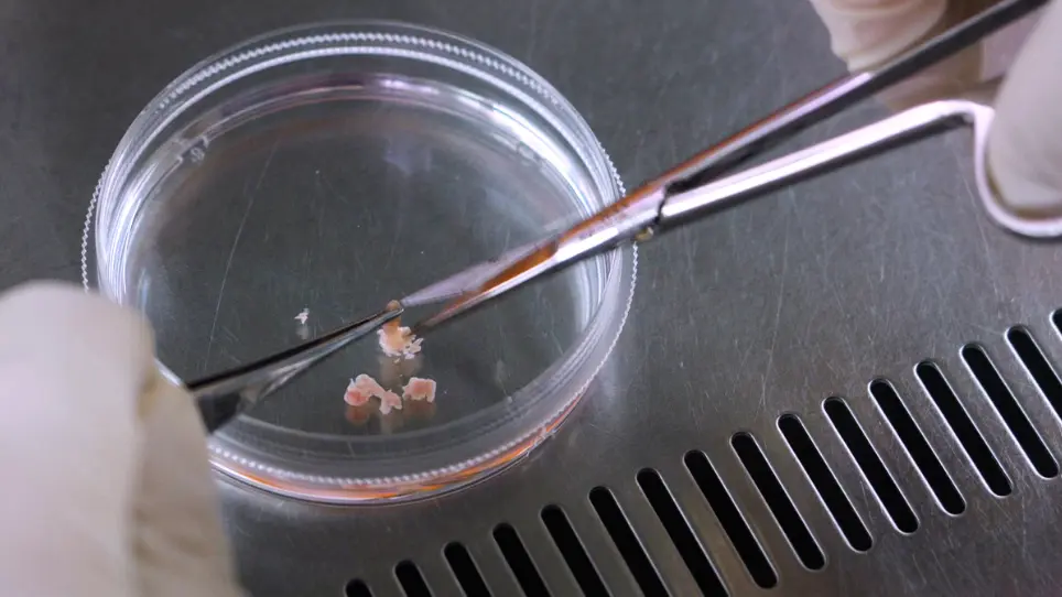 Three-Dimensional, Serum-Free Culture System for Lacrimal Gland Stem Cells