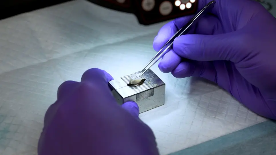 Measuring Cerebral Vasospasm after Subarachnoid Hemorrhage in Mice