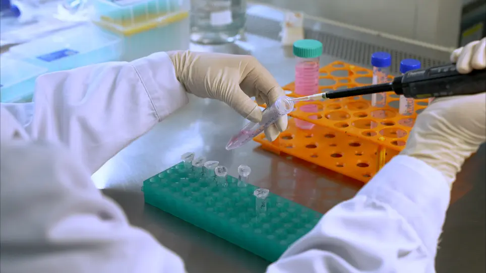 Purification of Ubiquitinated p53 Proteins from Mammalian Cells