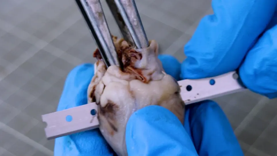 Dissection Techniques and Histological Sampling of the Heart in Large Animal Models for Cardiovascular Diseases