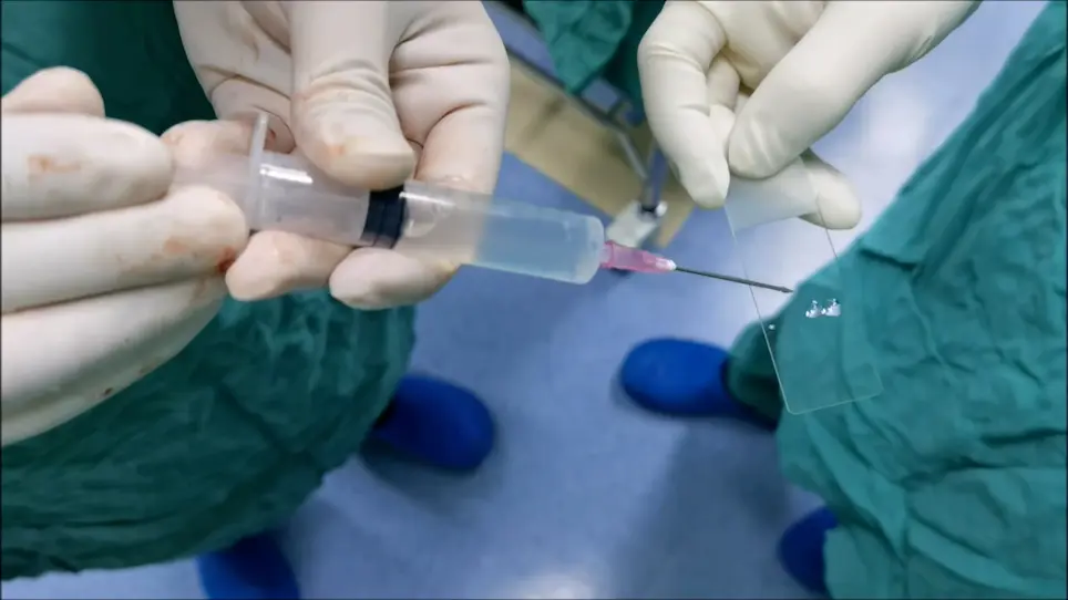 Clinical Application of 24 G Cannula Needle and 3-0 Polypropylene Suture in Vas Deferens Exploration