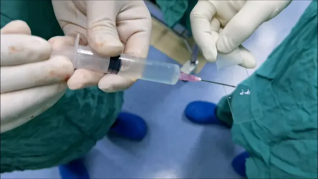 Clinical Application of 24 G Cannula Needle and 3-0 Polypropylene Suture in Vas Deferens Exploration