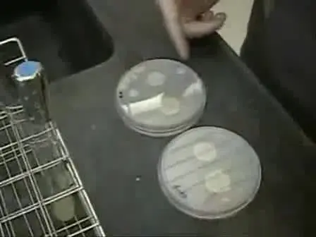 Assay for Adhesion and Agar Invasion in S. cerevisiae