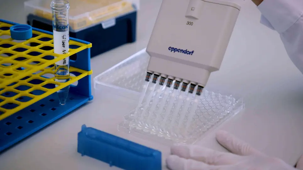 A Simple Pit Assay Protocol to Visualize and Quantify Osteoclastic Resorption <em>In Vitro</em>