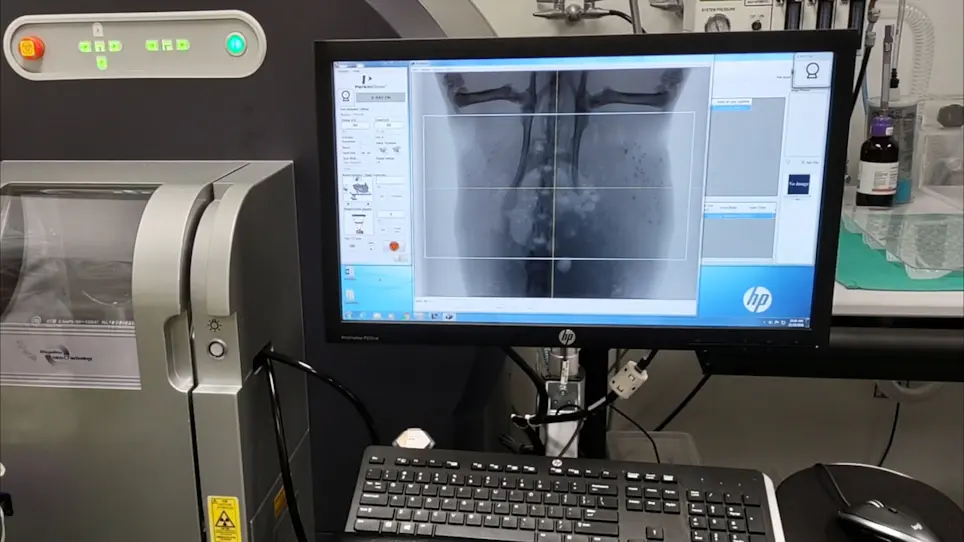 X-Ray Visualization of Intraductal Ethanol-Based Ablative Treatment for Prevention of Breast Cancer in Rat Models