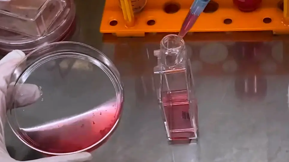 Isolation of Monocyte-Macrophage Lineage Cells from Rat Bones by Secondary Adherence Method