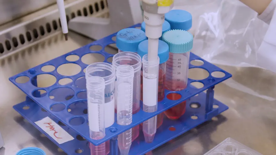Generation of Natural Killer Cells from Human Expanded Potential Stem Cells