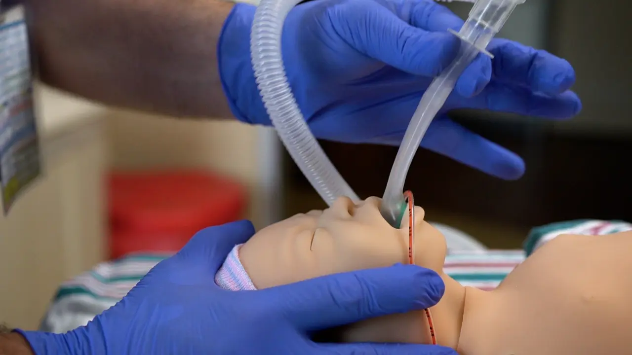 Laryngeal Mask Airway (LMA) Placement in a Neonatal Patient Simulator Using a Non-Inflatable Supraglottic Airway (SGA)