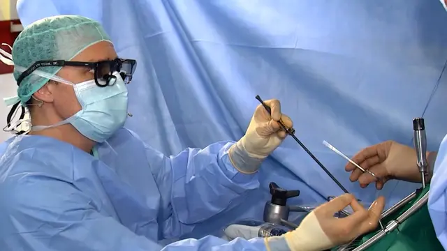 Fully Endoscopic Mitral Valve Repair with Percutaneous Cannulation of Groin Vessels