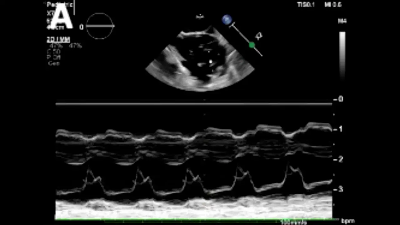 Model of Ischemia and Reperfusion Injury in Rabbits