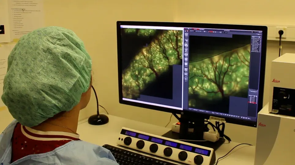 Laser Ablation and Intravital Microscopy to Study Intestinal Remodeling
