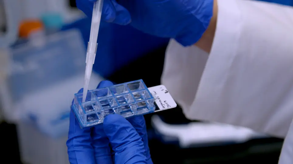 Visualizing DNA Damage Repair Proteins in Patient-Derived Ovarian Cancer Organoids <em>via</em> Immunofluorescence Assays