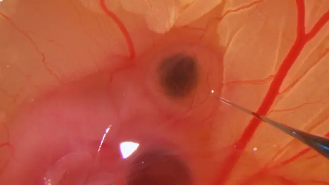 Using the Chick Embryo Brain as a Model for <em>In Vivo</em> and <em>Ex Vivo</em> Analyses of Human Glioblastoma Cell Behavior