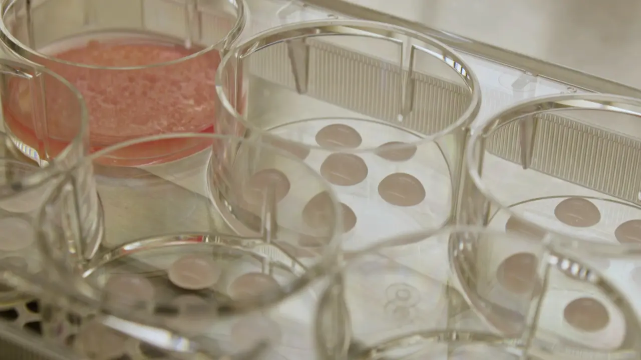 Establishment of Pancreatic Cancer-Derived Tumor Organoids and Fibroblasts From Fresh Tissue