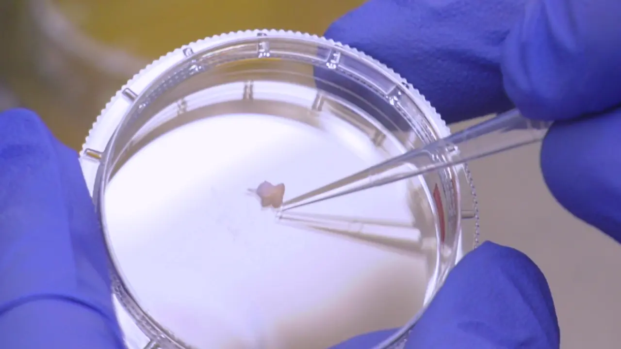 Generation of Patient-Derived Podocytes from Skin Biopsies