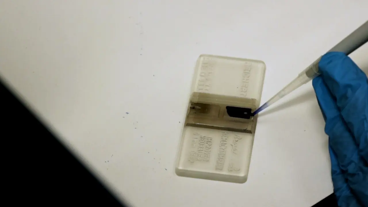 Screening Ion Channels in Cancer Cells
