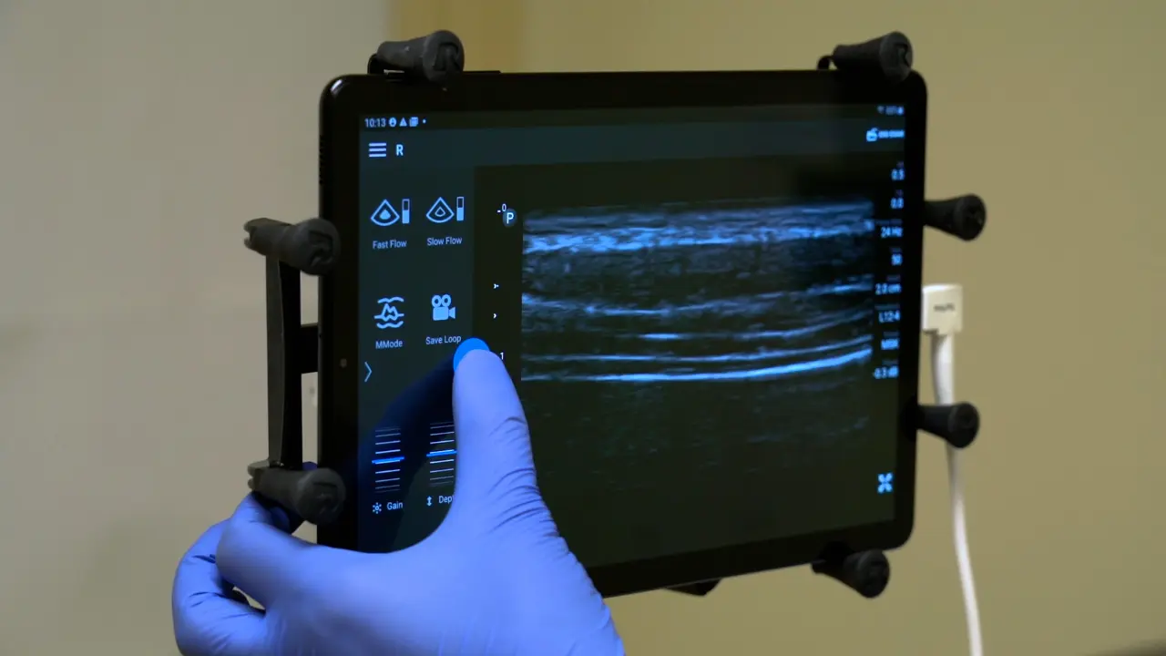 Measuring Diaphragm Thickness and Function Using Point-of-Care Ultrasound