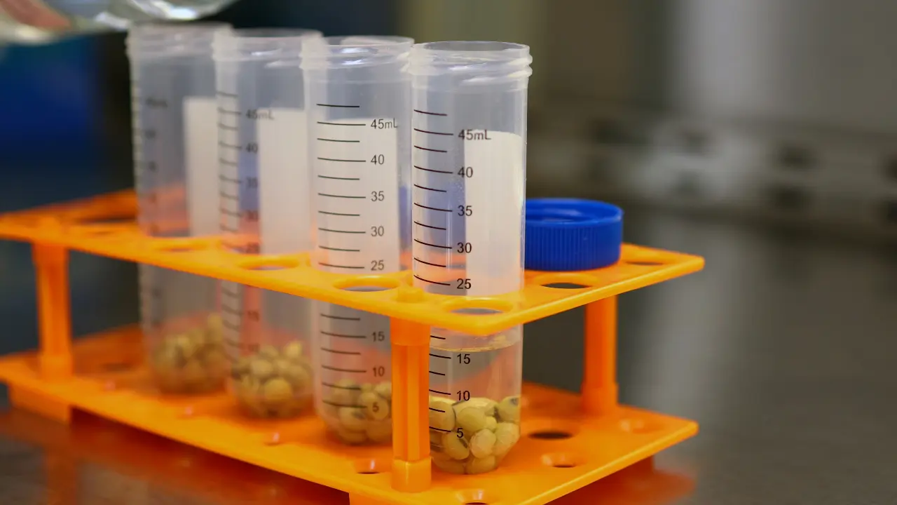 Soybean Hairy Root Transformation for the Analysis of Gene Function