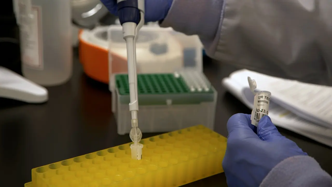Cell-Free DNA Extraction of Vitreous and Aqueous Humor Specimens for Diagnosis and Monitoring of Vitreoretinal Lymphoma