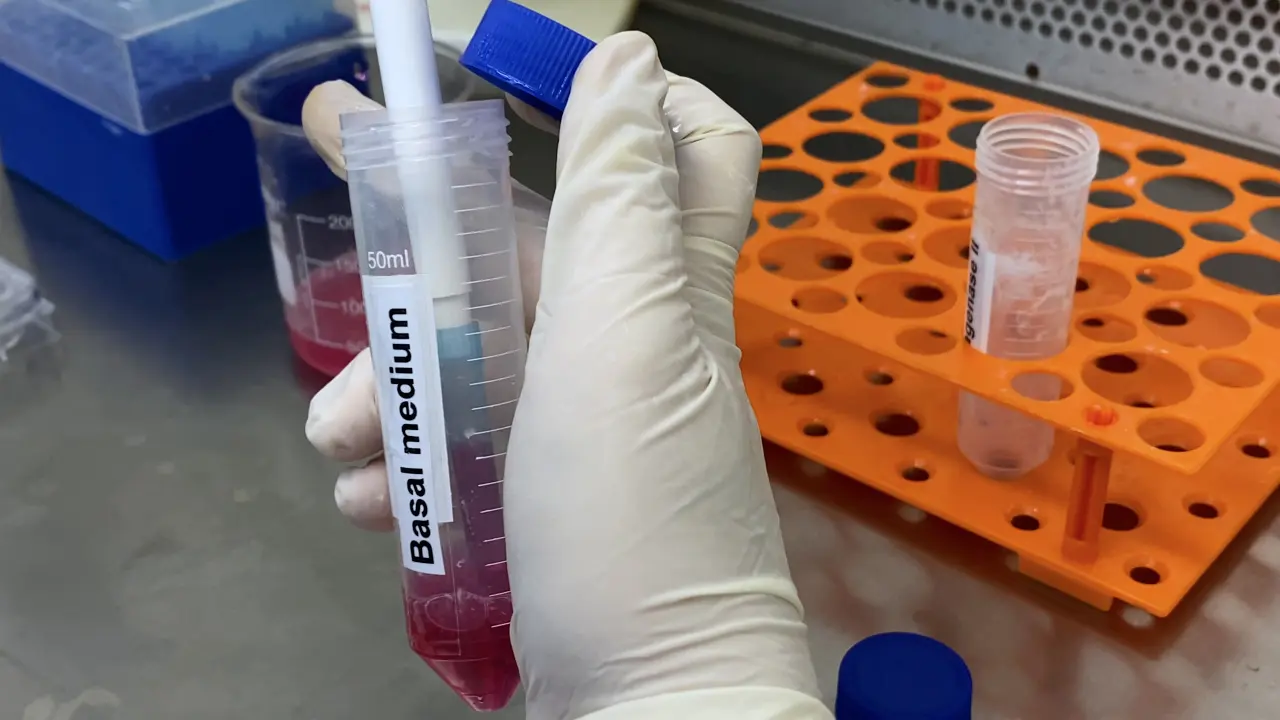 Isolation, In Vitro Expansion, and Characterization of Mesenchymal Stem Cells from Mouse Epididymal Adipose Tissue