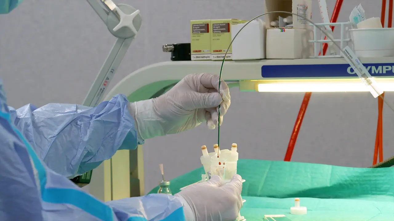 Using the Endoscope for Endobronchial Ultrasound in the Esophagus