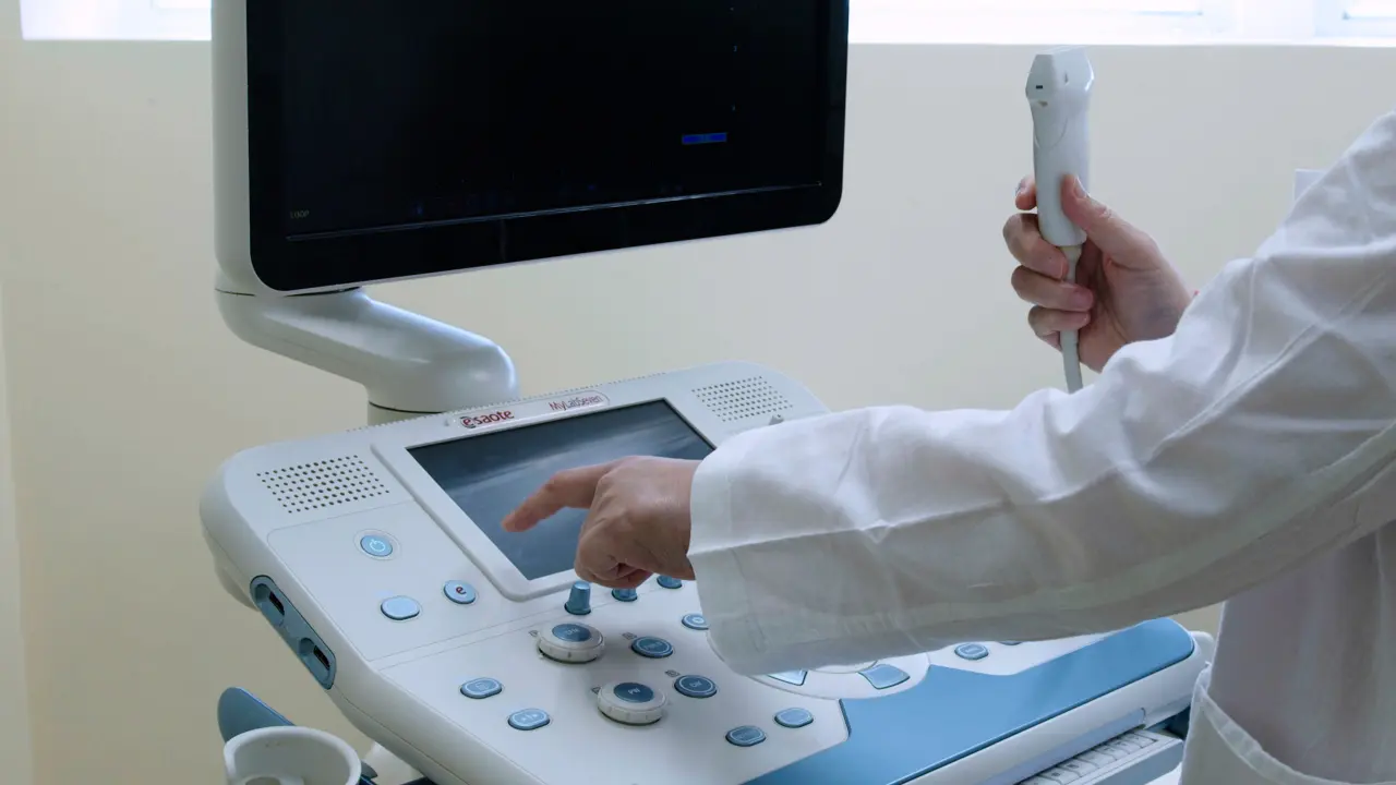 Ultrasonographic Evaluation of Salivary Glands for Sjogren's Syndrome: Diagnostic and Monitoring Insights