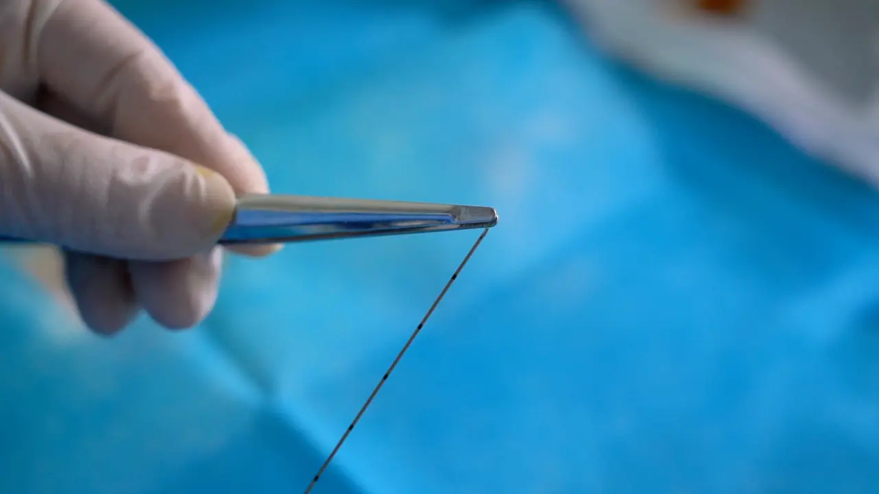 Operation Procedure and Precautions of Thread-Embedding Acupuncture Therapy in Alzheimer