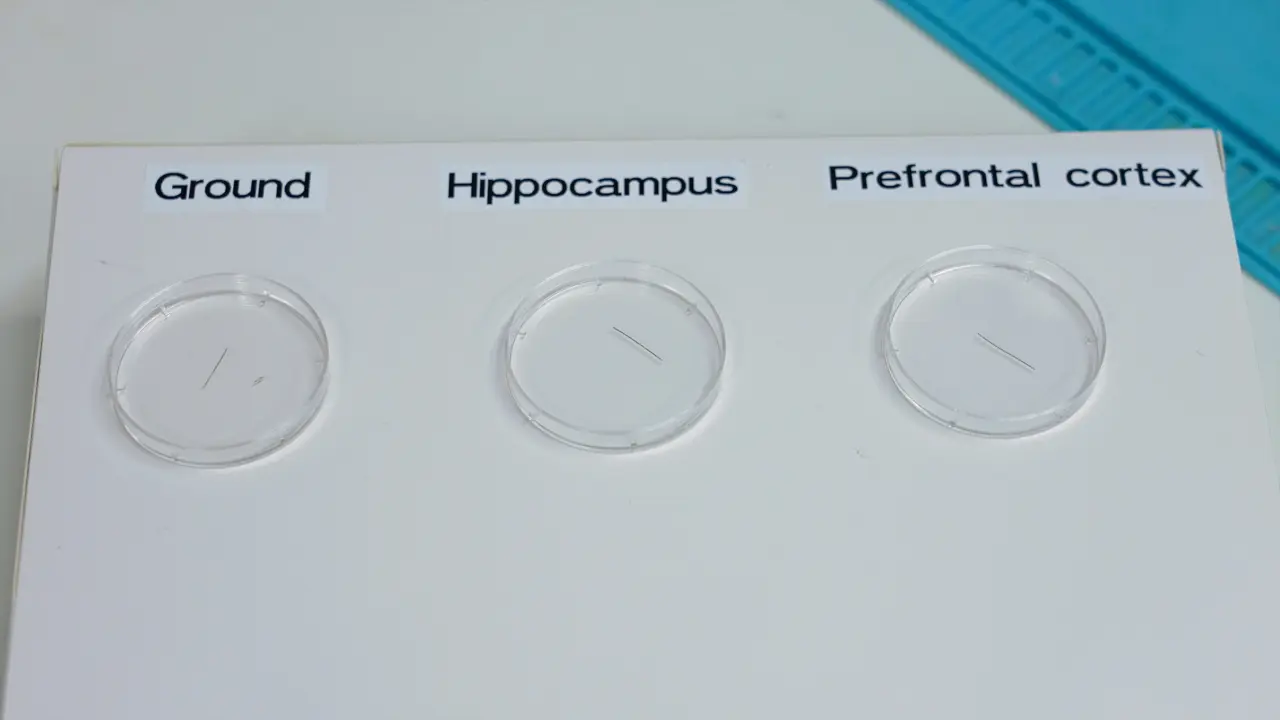 Dual Extracellular Recordings in the Mouse Hippocampus and Prefrontal Cortex