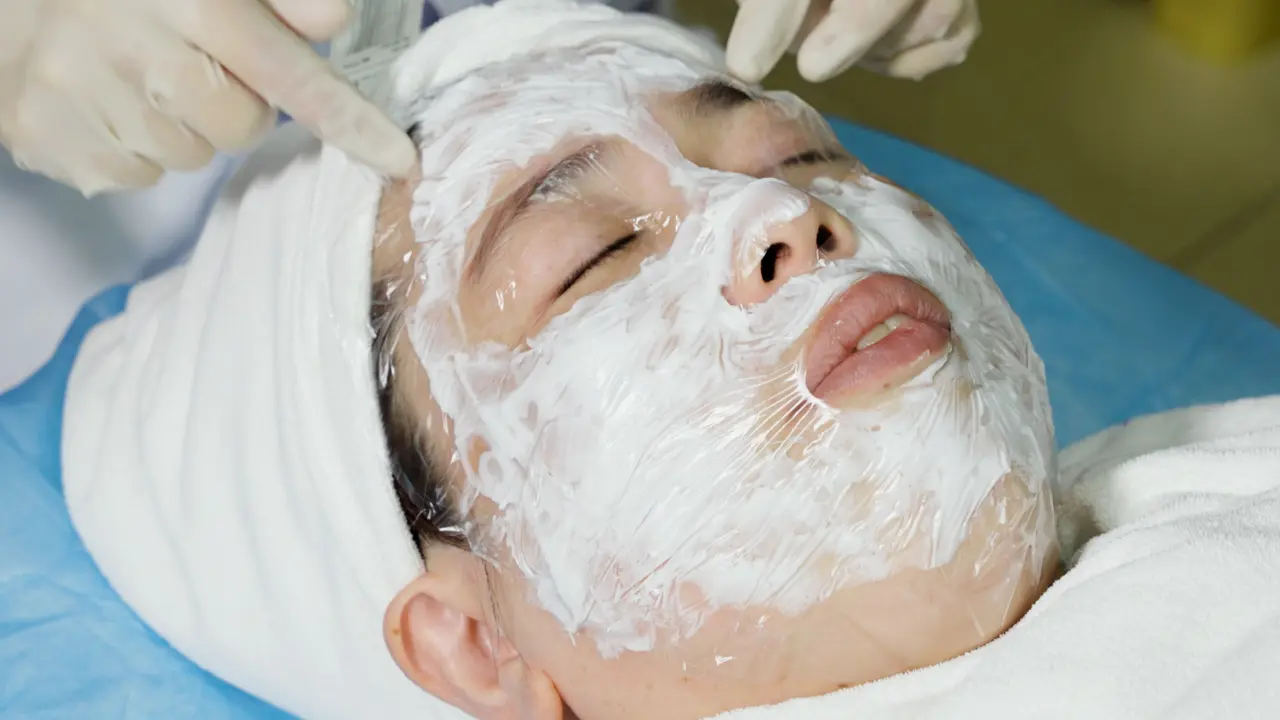 Roller Microneedle Combined with Tranexamic Acid Solution in Treating Melasma