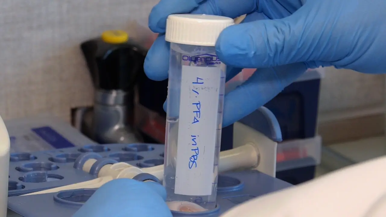 Obtaining High-Quality Cryosections of Whole Rabbit Eye