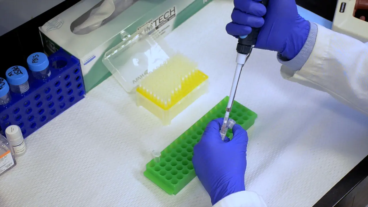 Quantification of Autoreactive Antibodies in Mice upon Experimental Autoimmune Encephalomyelitis