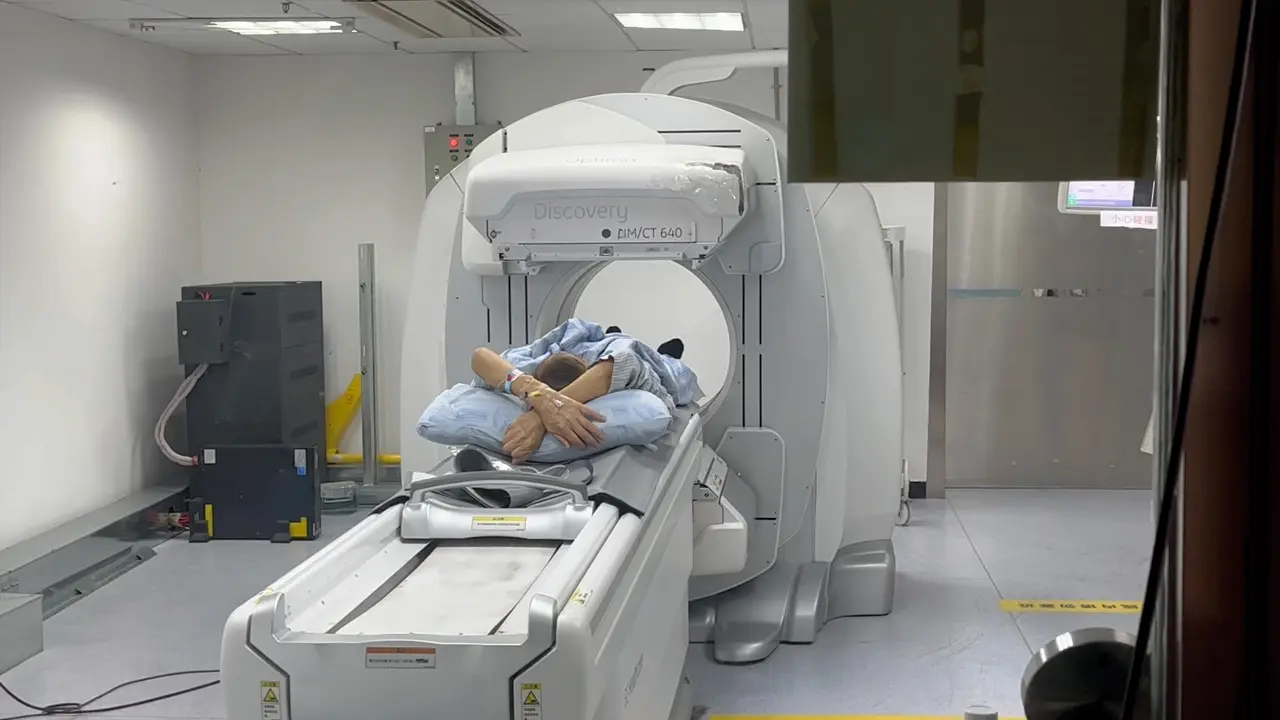 Y-90 Radioembolization and PD-1 Inhibitor as Neoadjuvant Treatment in Hepatocellular Carcinoma
