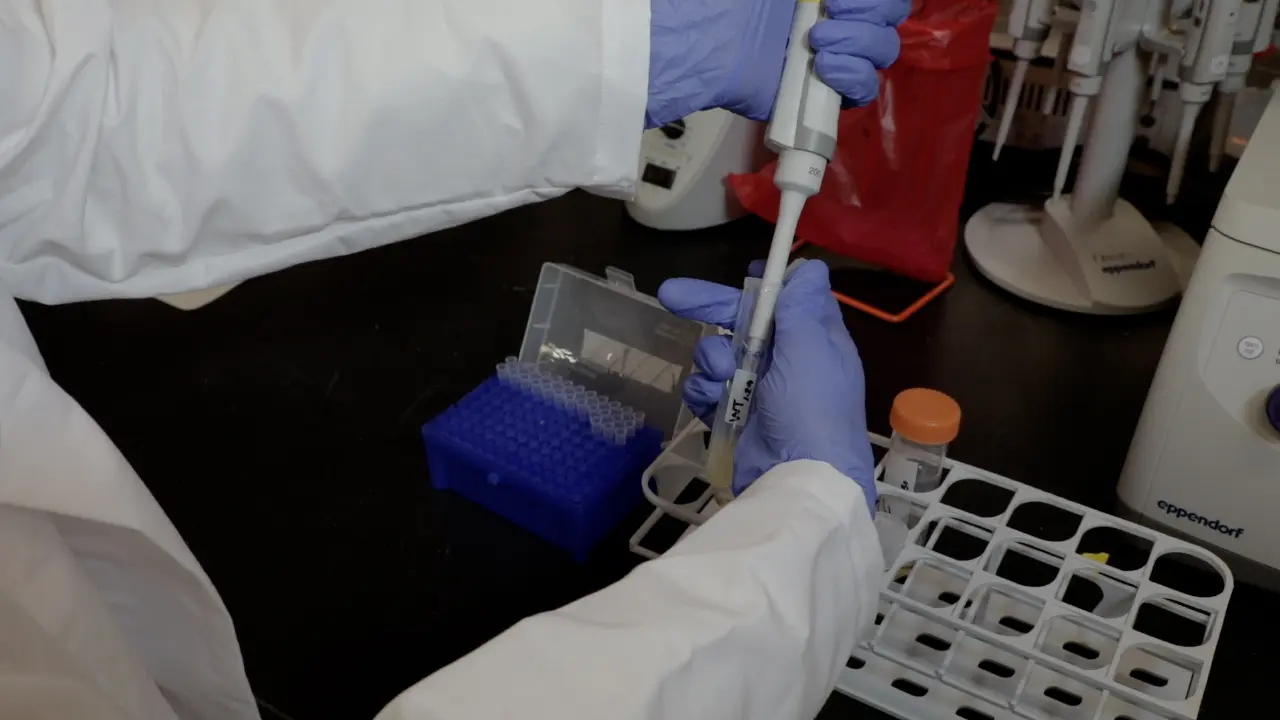 Epithelial Cell Infection Analyses with <em>Shigella</em>