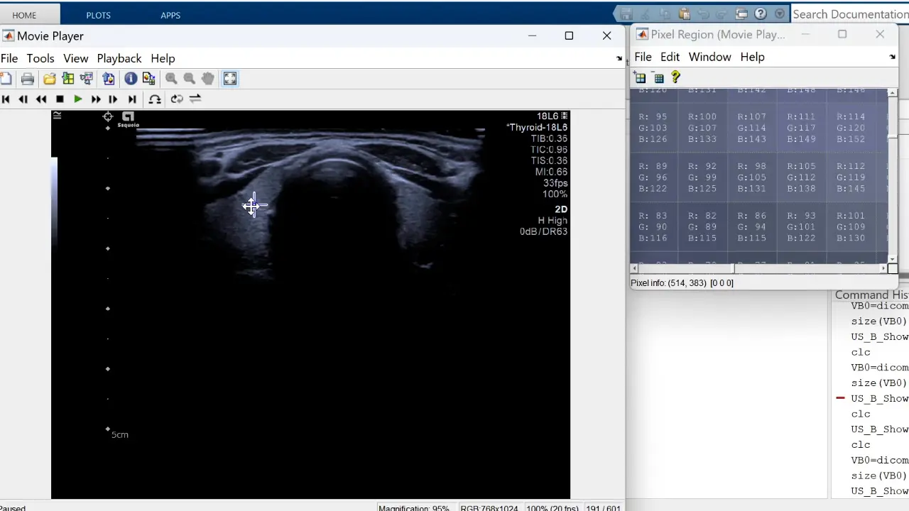 Synchronous Triplanar Reconstruction Integrated with Color Doppler Mapping for Precise and Rapid Localization of Thyroid Lesions