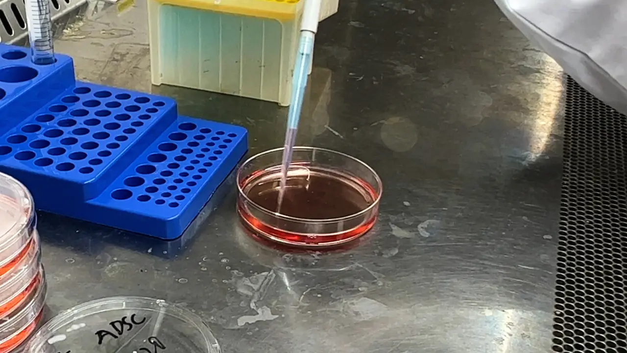 Purification and Characterization of Extracellular Vesicles from Human Adipose-Derived Mesenchymal Stem Cells