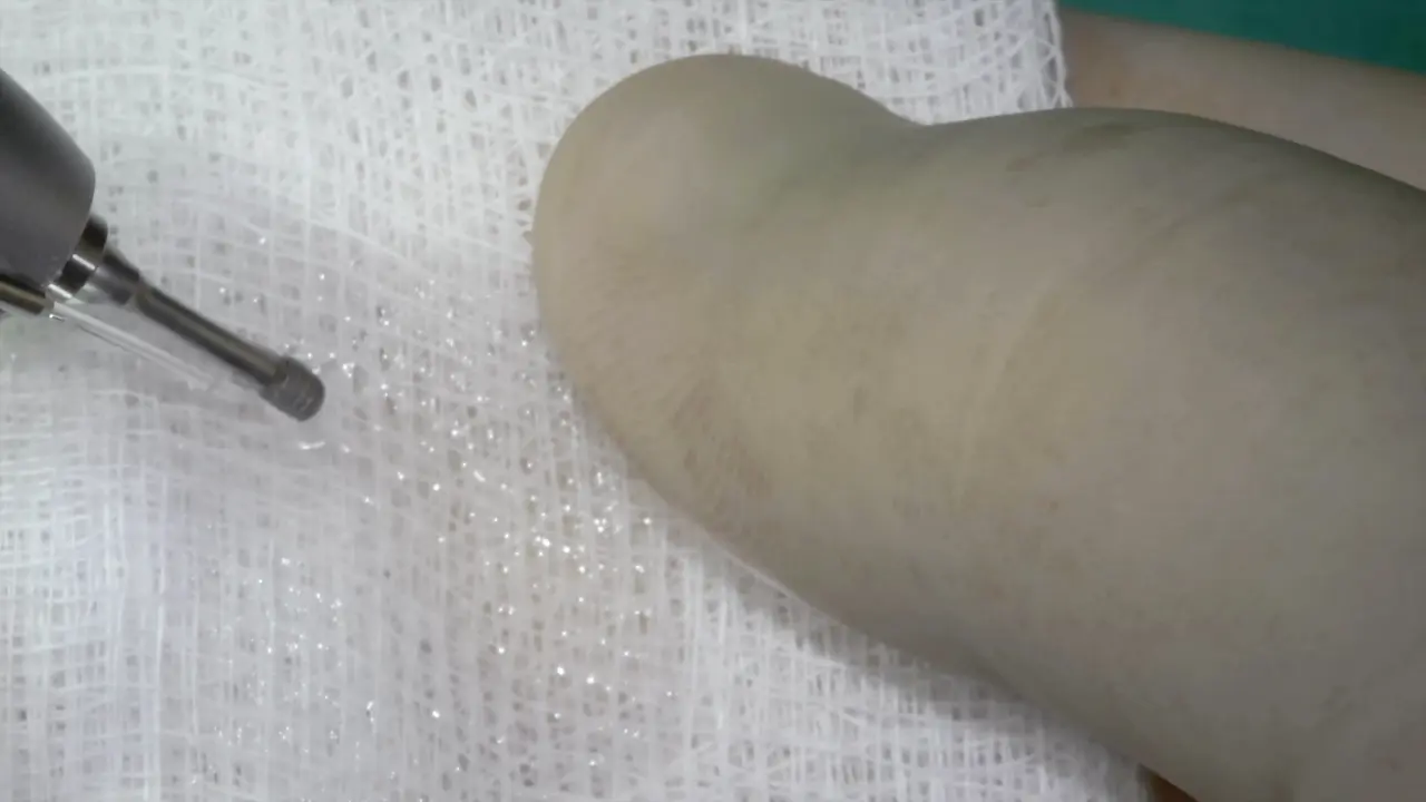 Surgical Bone Implantation Technique for Rat Tibia Models of Diabetes and Osteoporosis