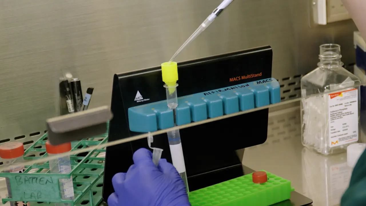 Studying Adipose Endothelial Cell/Adipocyte Cross-Talk in Human Subcutaneous Adipose Tissue