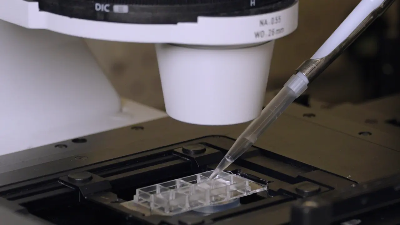 Alternative Methods for the Detection of Superoxide Anion Generation in Platelets