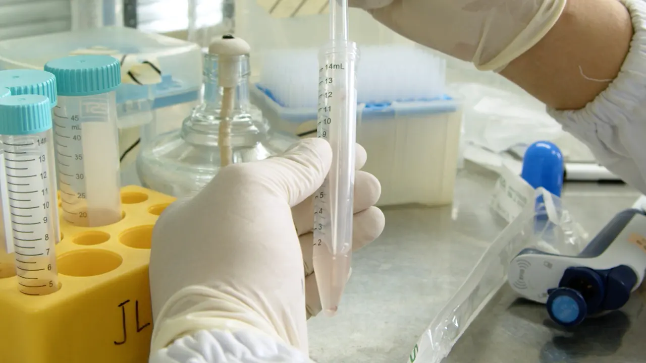 In Vitro Differentiation of Naive CD4<sup>+</sup> T Cells into Pathogenic Th17 Cells in Mouse