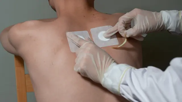 Acupoint Application Combined with Ear Plaster Therapy for Treating Sleep Disorders with Acute Exacerbation of Chronic Obstructive Pulmonary Disease