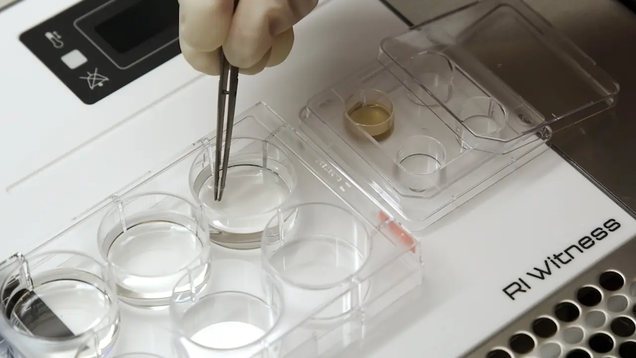 Vitrification of Ovarian Cortex Tissue to Achieve a Glassy State of Aggregation