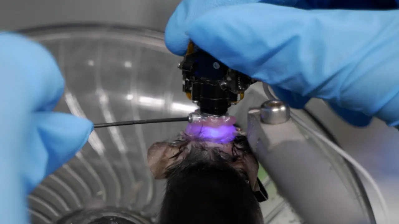 In Vivo Calcium Imaging of Granule Cells in the Dentate Gyrus of Hippocampus in Mice