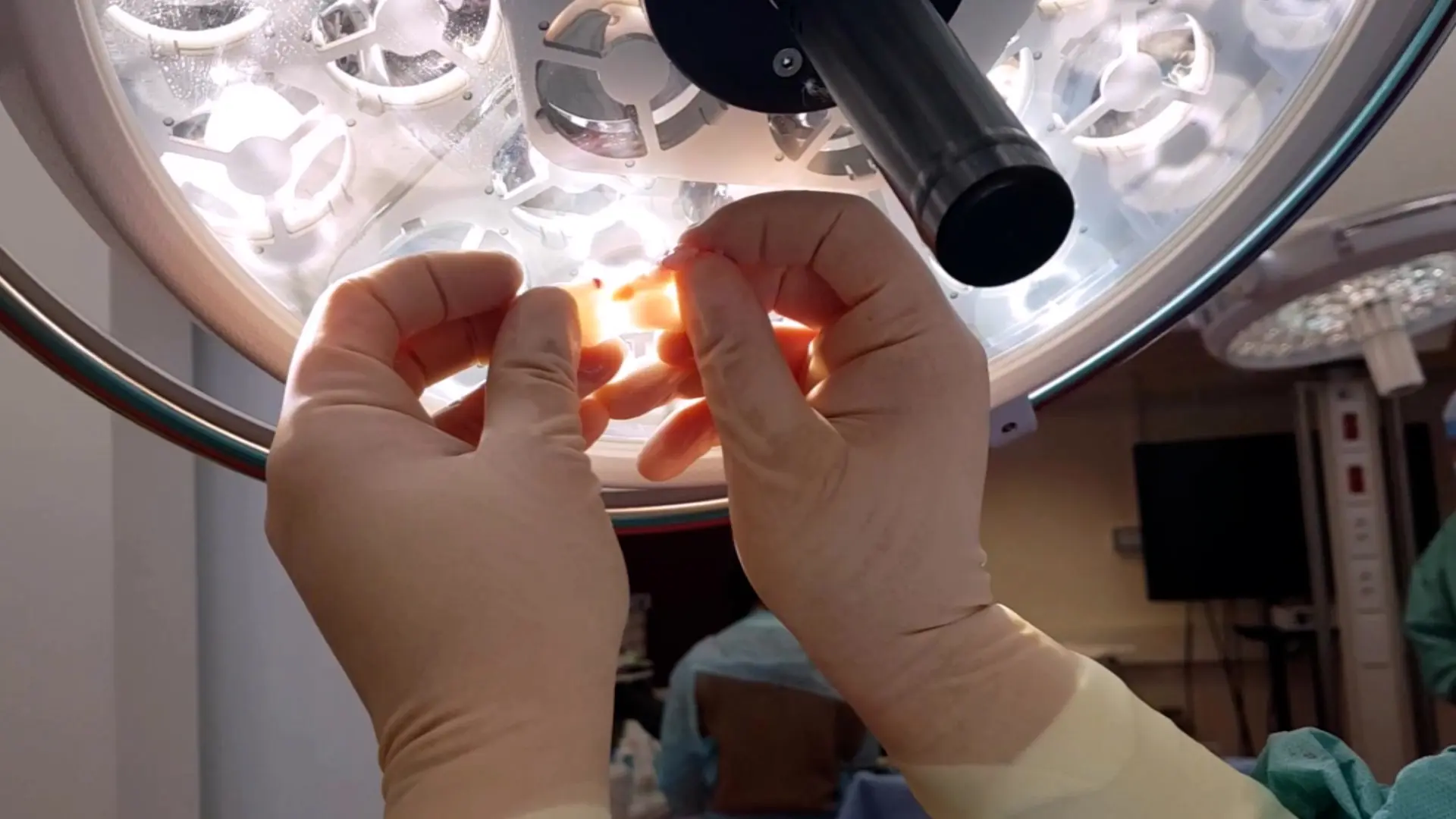 Procurement of Parathyroid Glands from Living Donor Pigs and <em>Ex Vivo</em> Identification