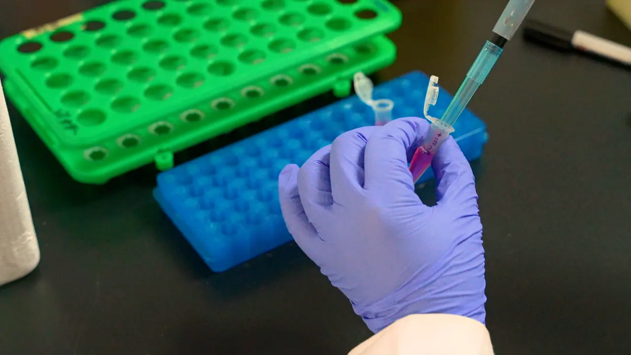 Effective Detection of Hoechst Side Population Cells by Flow Cytometry
