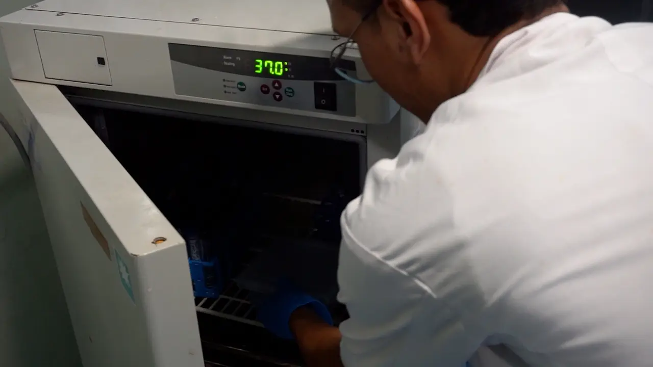 One-step Extraction and Zymographic Analysis of Bacterial Gelatinases