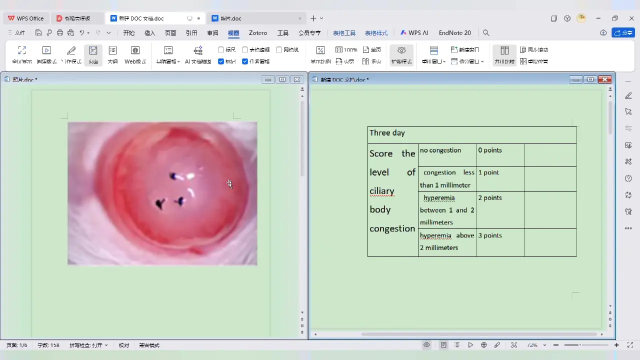 Establishing a Severe Corneal Inflammation Model in Rats Based on Corneal Epithelium Curettage Combined with Corneal Sutures