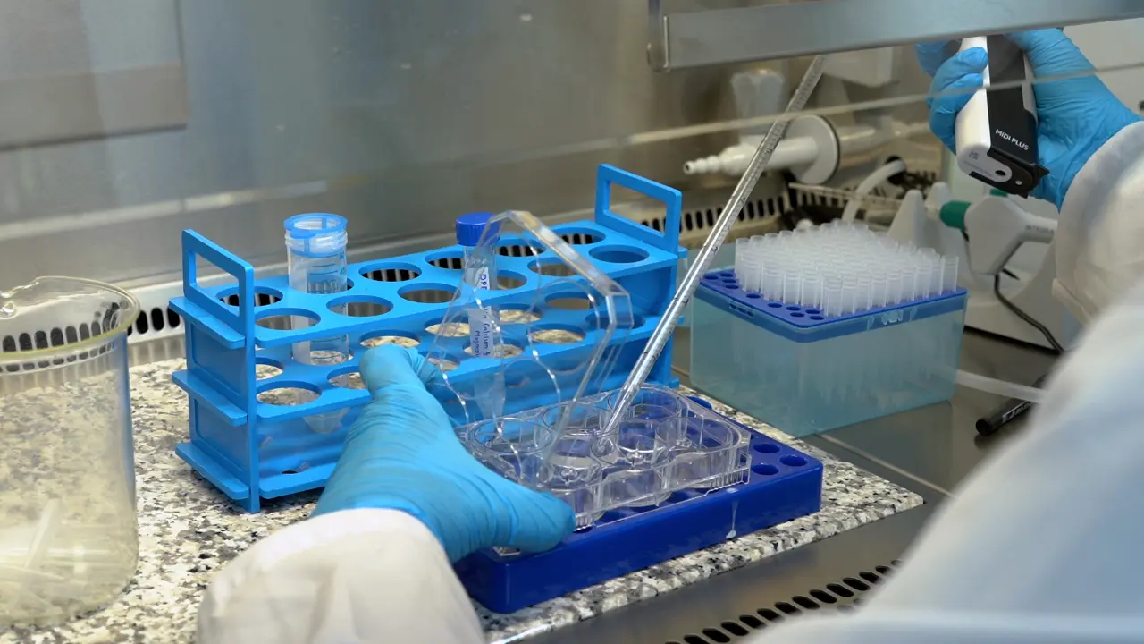 <em>In Vitro</em> Modeling of Down Syndrome Neurogenesis Using Human-Induced Pluripotent Stem Cells